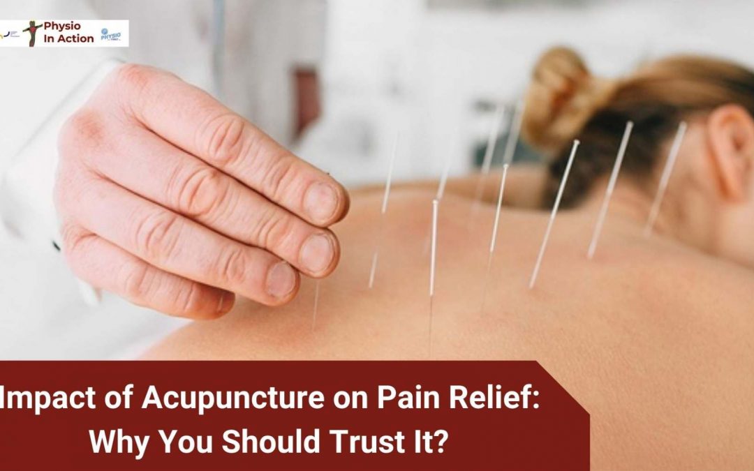 Impact of Acupuncture on Pain Relief: Why You Should Trust It?