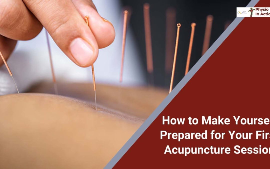 How to Make Yourself Prepared for Your First Acupuncture Session